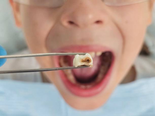Best Emergency Cosmetic Dentistry (e.g., broken veneers) in Chigan Center, MI